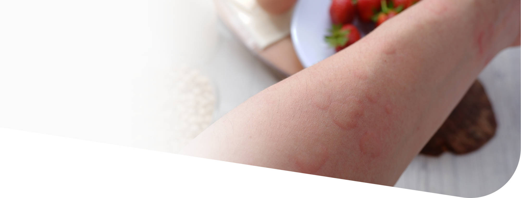 Аллергия на коже